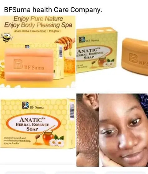 AnaticTM Herbal Essence Soap